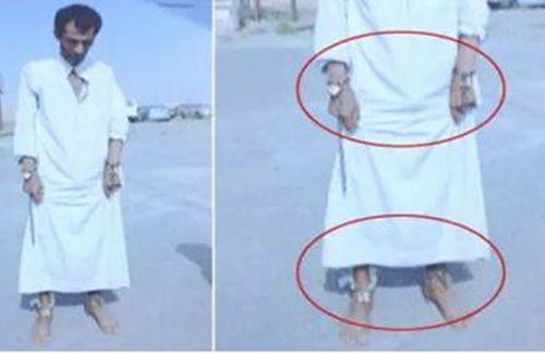 ماهى قصة الساحر الحوثي الذي استهدف عناصر الجيش السعودي؟ 131313111111