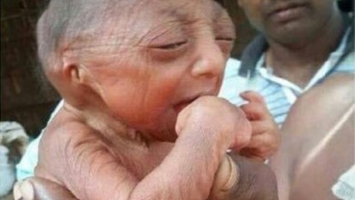 بالصورة: مولود غريب في بنغلاديش يقدّر الأطباء عمره بـ 110 سنوات 22e5a5cd7b5459723d18aa5940d4b171 L