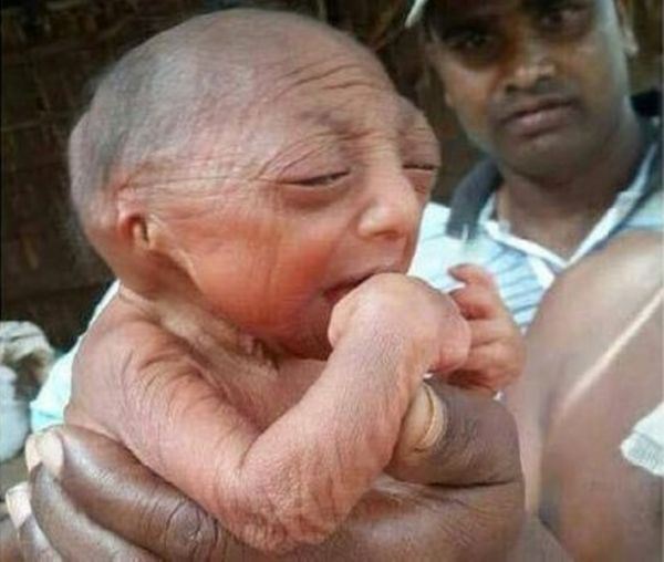 بالصورة: مولود غريب في بنغلاديش يقدّر الأطباء عمره بـ 110 سنوات 22e5a5cd7b5459723d18aa5940d4b171 L