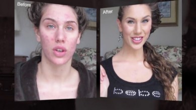 فيديو صادم لإخفاء الحبوب بالمكياج 1449751456 slider acne