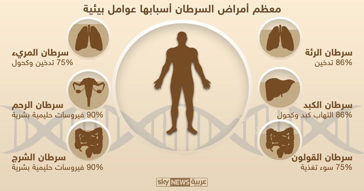 دراسة: معظم أنواع السرطان بسبب "أنماط الحياة" سرطان