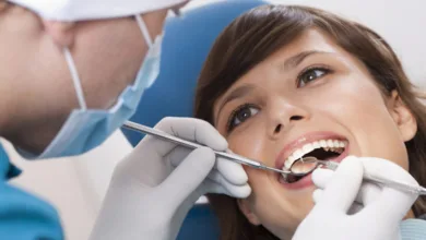 ليست الحلويات فقط.. أطعمة صادمة تسبب تسوس الأسنان دون أن تشعر طبيب اسنان