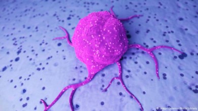 علامات مرض السرطان