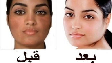 الطيب مصطفي يكتب :كريمات التفتيح وعقدة النقص,و مدير قناة النيل الازرق يصرح :(نوظف مذيعات سمر وبيصبح لونهن أبيض)! كريم البشرة