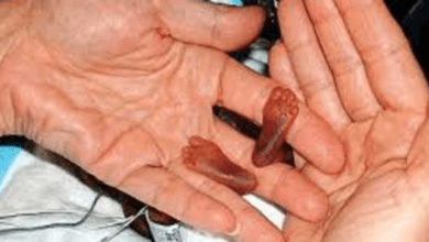 وزير الصحة بالمغرب يعلن تأييده الإجهاض معتبرا ان المرأة حرة في جسدها اجهاض عمليات