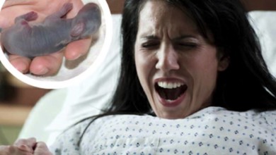 سيدة مغربية تنجب “أرنب” والمستشفى تحيلها للنائب العام سيدة تنجب ارنب