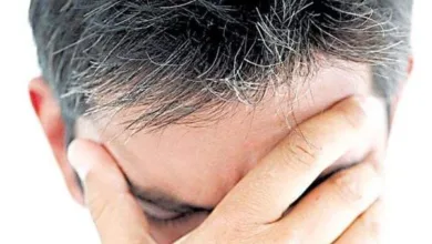 الشيب الشعر