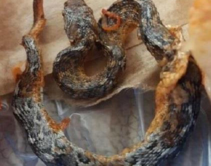بالصور: أفعى سامة تلدغ طفلة بنجران.. ووالدها يكشف عن حالتها الصحية image 2