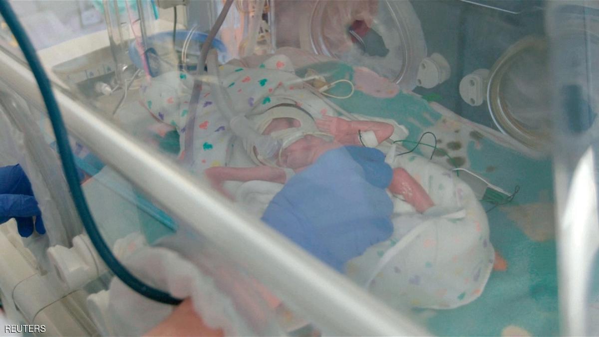 ابتكار طبي ثوري.. تجربة أول رحم اصطناعي بنجاح 1 943503