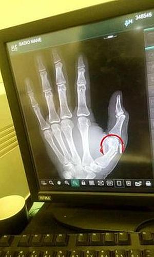 صورة : نجم ليفربول “ساديو ماني” يتسبب في إيقاف موظف في مستشفى سوداني ومصادر تكشف السبب ماني 2