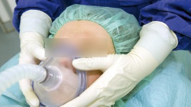 أثناء عملية التجميل