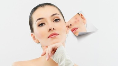 البقع الداكنة