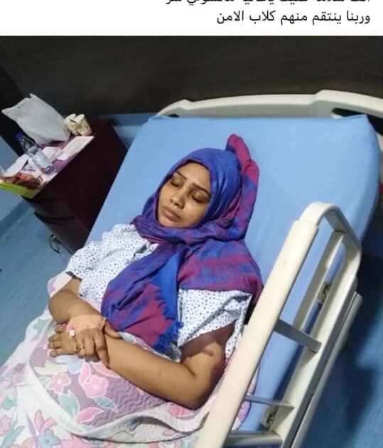 خبيرة تجميل تتعرض للتعذيب علي ايدي ملثمين مصابه
