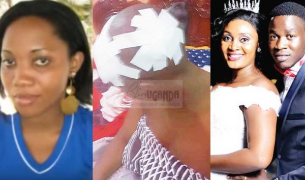 ضبطها بالجرم المشهود.. ملكة جمال تدخل المستشفى بعد انتقام زوجها خيانه زوجيه