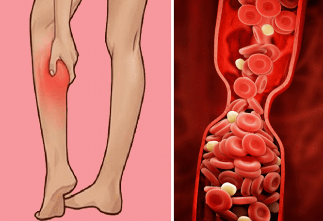 91545 تغير لون البشرة