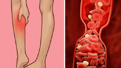 91545 تغير لون البشرة