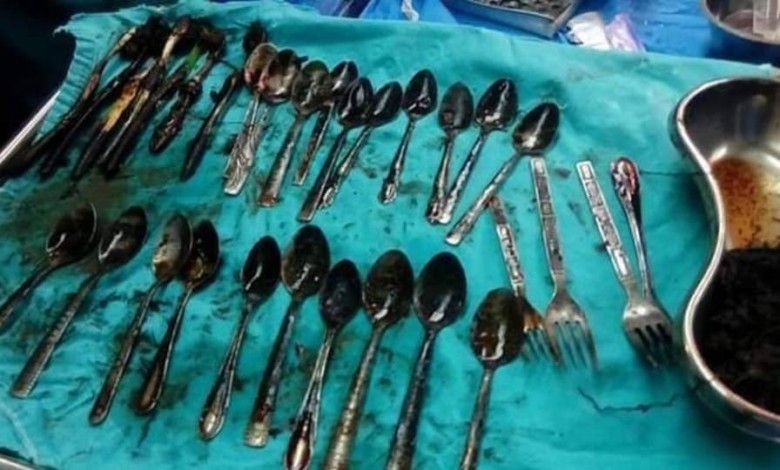 استخراج 20 ملعقة ومجوهرات من بطن مريض 21d0be33 d079 4765 839a 3b2b50d4a013 16x9 1200x676