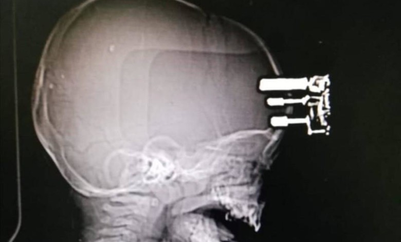 رضيع يسقط برأسه مباشرة على شاحن جوال رضيع