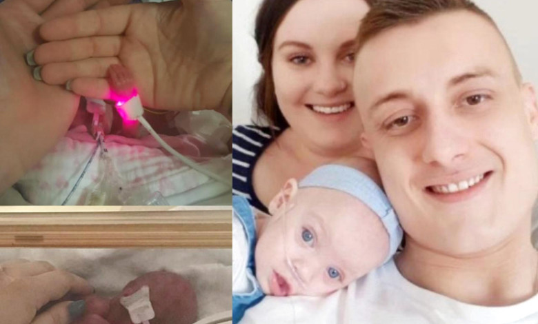 ولدت بحجم أصغر من «الهاتف».. وعاشت image