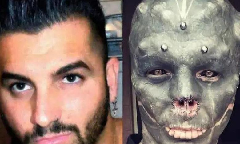 فرنسي يقطع أنفه وشفته العليا ليكون كائنا فضائيا 1611749196710012300 1