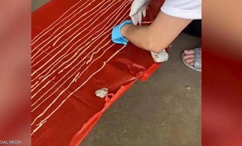 شعر بألم في بطنه فاستخرج الأطباء مفاجأة مروعة دودة