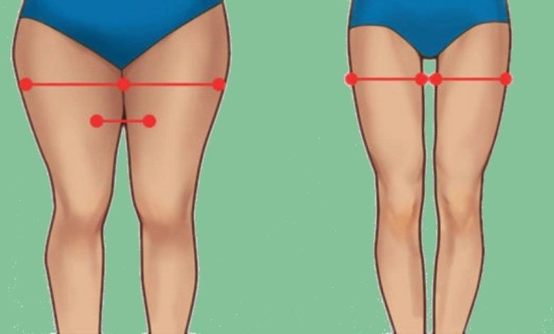 5 طرق فعالة للتخلص من دهون الفخذين.. منها المشى وتقليل الملح دهون الفخذين 1