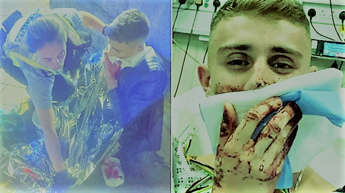 يحتاج جراحة لترميم الوجه.. بطل أولمبي يتعرض لهجوم خطير (صور) البطل جاك وولي