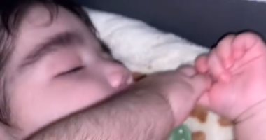 حالة نادرة لرضيع أمريكى يغطي الشعر جسمه بسبب عقار طبى .. فيديو وصور طفل كثيف الشعر