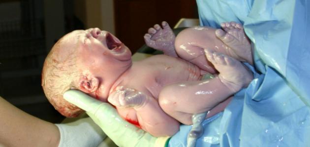 شاهد.. فيديو مُثير لـ جنين يحاول الخروج من الكيس “الأمنيوسي” بعد إخراجه من بطن أمه لحظة خروج جنين من بطن أمه