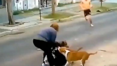 كلاب تهاجم سيدة