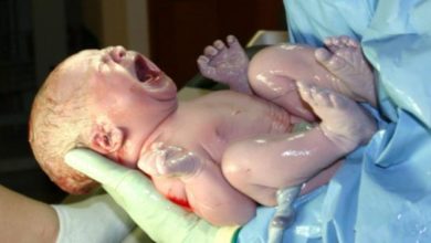 لحظة خروج جنين من بطن أمه