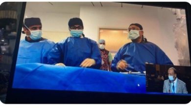 عملية على الهواء