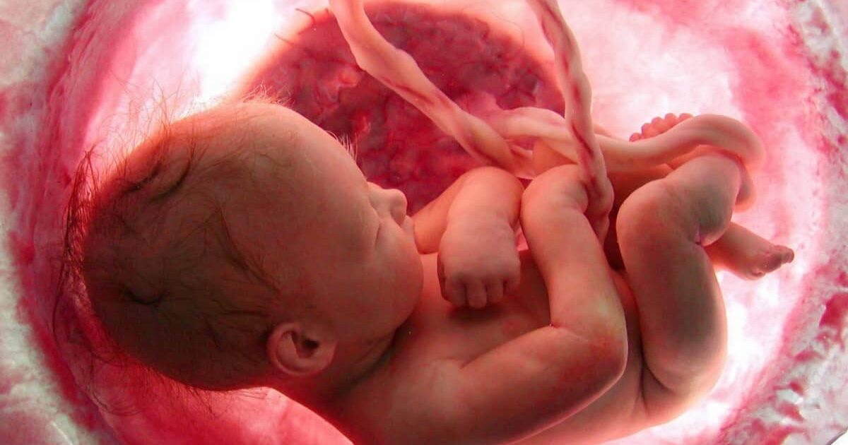حالة نادرة.. جنين متحجر (9) سنوات يقتل أمه جنين في رحم أمه