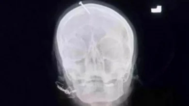 مسمار في راس