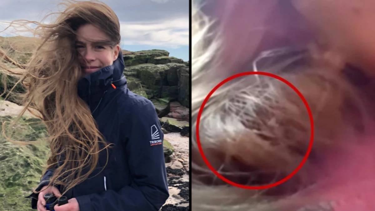 عصفور يعشش في شعر امرأة بريطانية 84 يوماً! عصفور شعر فتاة