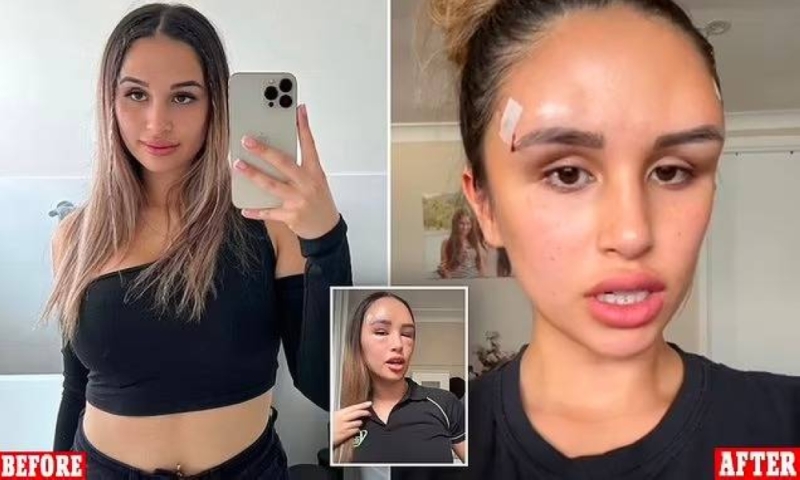 عملية عارضة ازياء