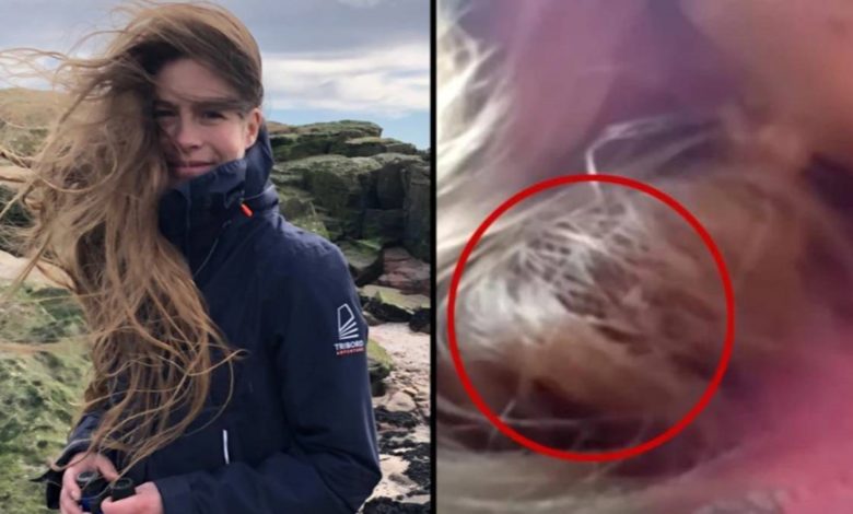 عصفور يعشش في شعر امرأة بريطانية 84 يوماً! عصفور شعر فتاة