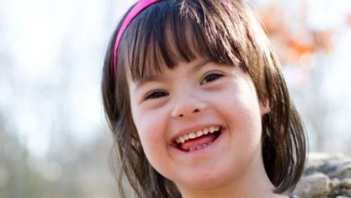 متلازمة داون