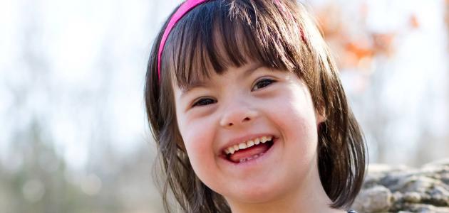 توقع الطبيب موتها خلال عام.. بالفيديو: مواطنة سعودية تتحدى مرض ابنتها بمتلازمة داون وتغير حياتها متلازمة داون