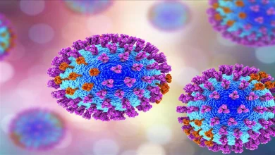 انفلونزا الطيور