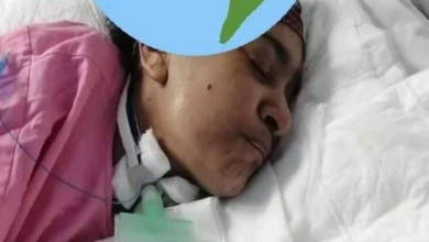 مقيمة سودانية غيبوبة