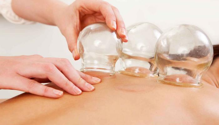 استشاري يكشف عن 5 أمراض يمكن علاجها بالحجامة 127 111211 health benefits cupping