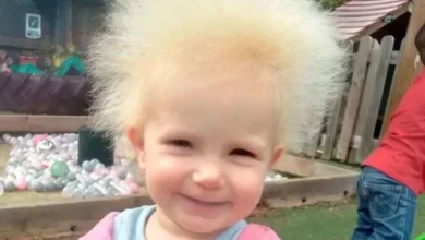 متلازمة شعر الممسحة e1659426514437 768x432 1