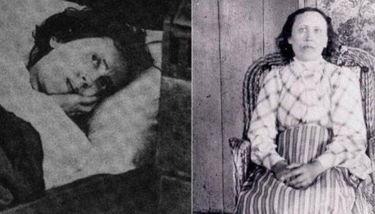 فتاة أوكنو.. نامت 32 عاماً فحيّرت الأطباء والعلماء 135 133030 okno gir slept 32