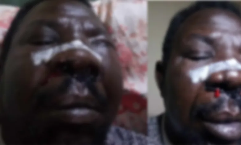 جندي سوداني يدفن عينه بيده ويستعد للعودة إلى القتال رغم الإصابة جندي سوداني