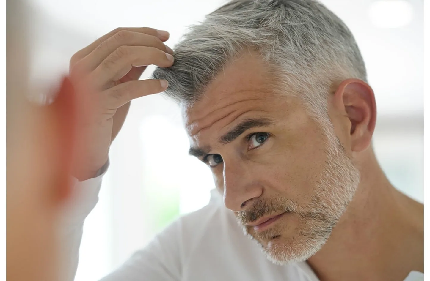 الشيب المبكر