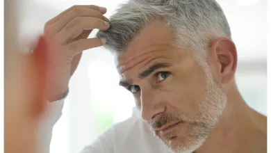 الشيب المبكر