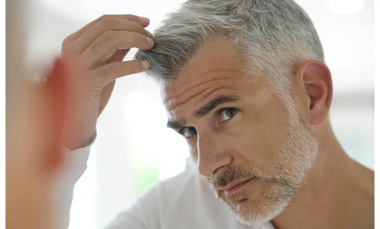 الشيب المبكر