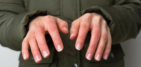 برودة اليدين والقدمين.. تحذير من الجسم لا تتجاهله downloadfile1 1