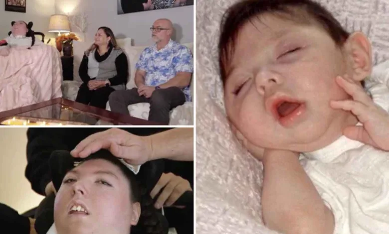 ولدت بلا دماغ